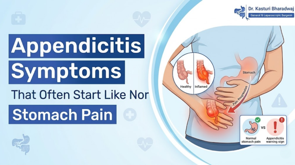 Illustration showing early appendicitis symptoms that start like normal stomach pain and progress to the lower right abdomen.