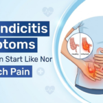 Illustration showing early appendicitis symptoms that start like normal stomach pain and progress to the lower right abdomen.