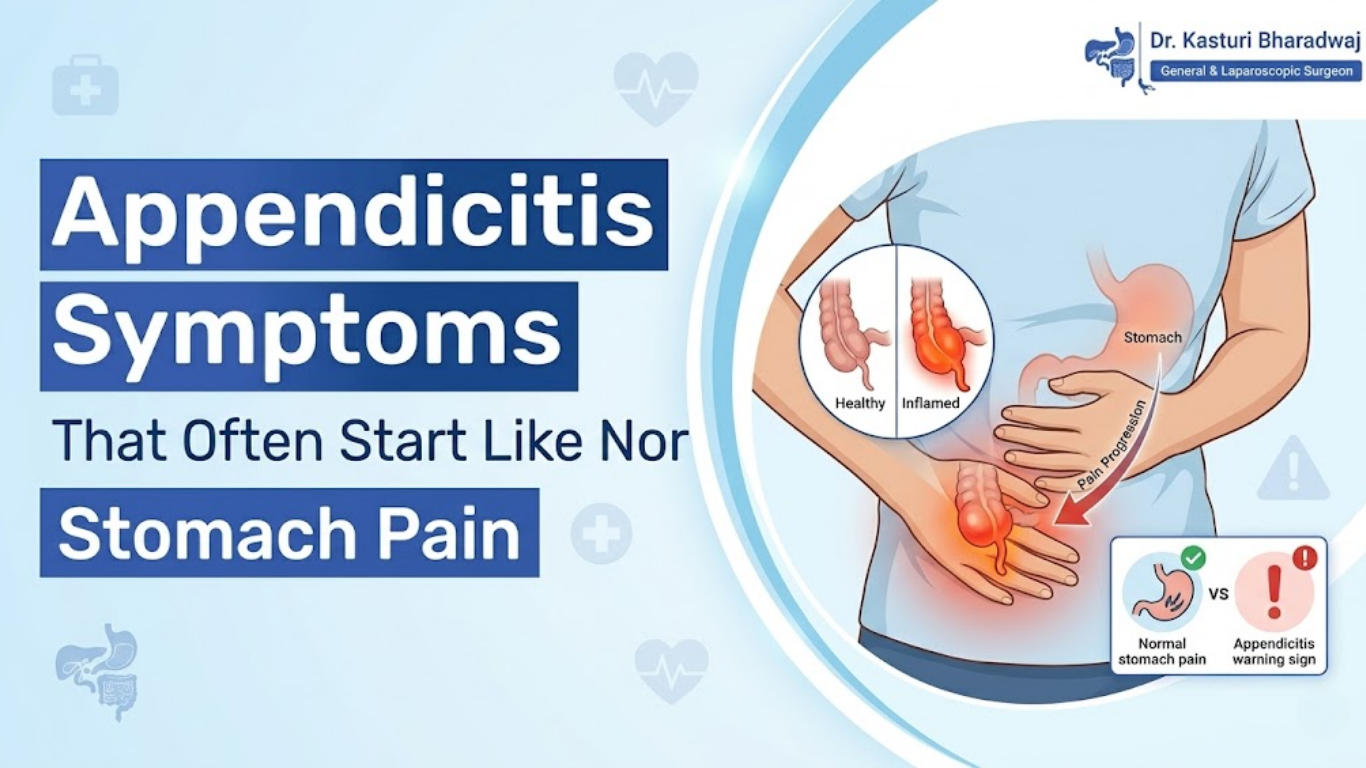 Illustration showing early appendicitis symptoms that start like normal stomach pain and progress to the lower right abdomen.