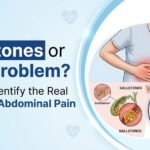 Difference between gallstone pain and gas pain showing abdominal pain locations